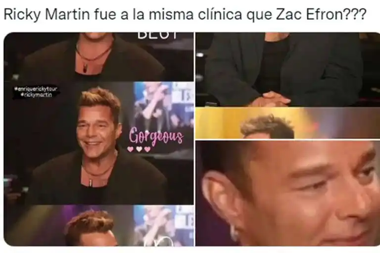 Ricky Martin se habría retocado la cara y en las redes lo compararon con otros famosos