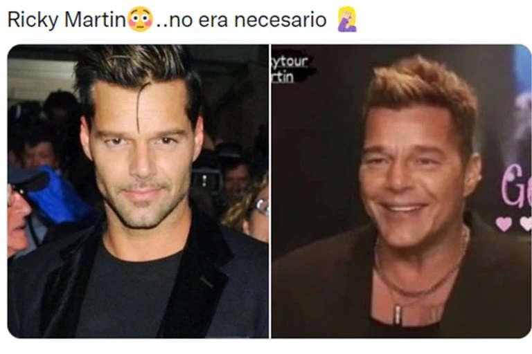 Ricky Martin se habría retocado la cara y en las redes lo compararon con otros famosos
