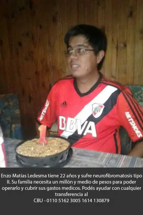 Una costurera tucumana necesita $1,5 millón para operar a su hijo, que sufre una rara enfermedad