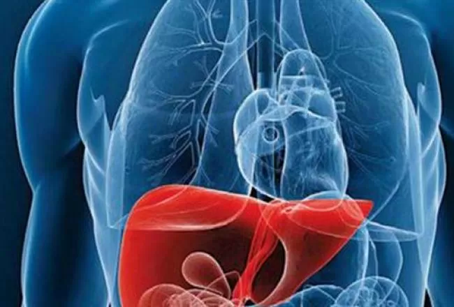 Una médica tucumana explica por qué no hay que subestimar el hígado graso