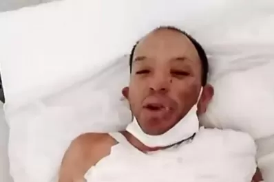 Agoniza la mujer que  habría sido quemada