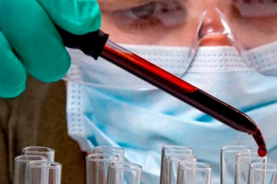 Una joven argentina se habría curado de VIH por inmunidad natural