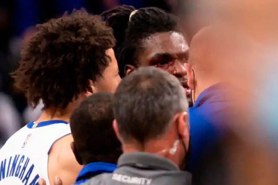IRA. Isaiah Stewart con su cara ensangrentada buscó por todos los medios a James.