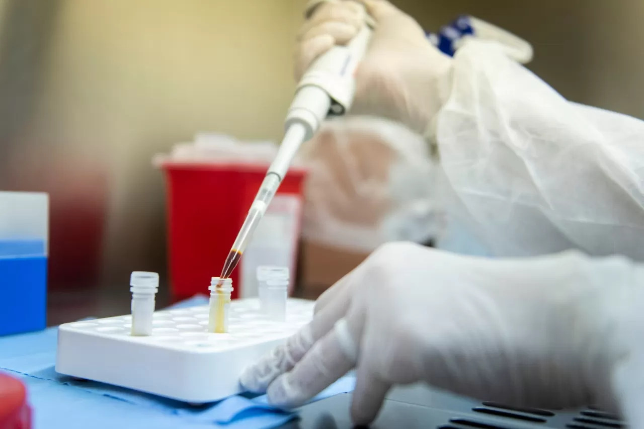 Coronavirus en Argentina: 33 muertes y 1.644 contagios en las últimas 24 horas