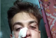 Agreden a un joven dentro de un boliche