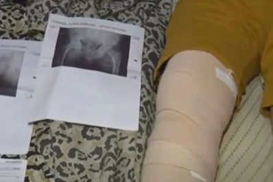 Córdoba: le operaron la rodilla, cuando debían intervenir su cadera