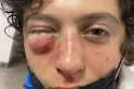 Ataque en patota: Por una patada, mi hijo pudo haber sido Báez Sosa