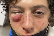 Ataque en patota: Por una patada, mi hijo pudo haber sido Báez Sosa