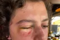 Rugby: de nuevo la mirada nublada