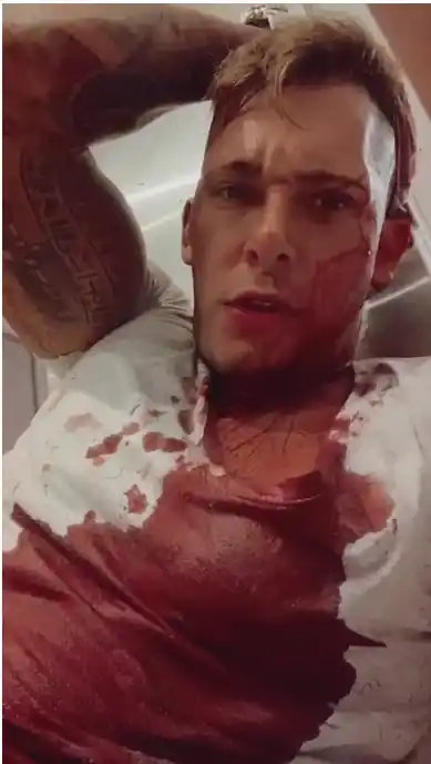 LA VÍCTIMA. Franco Lozano fue atendido de las heridas en el Padilla.  