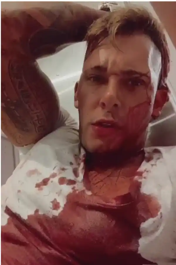 LA VÍCTIMA. Franco Lozano fue atendido de las heridas en el Padilla.  