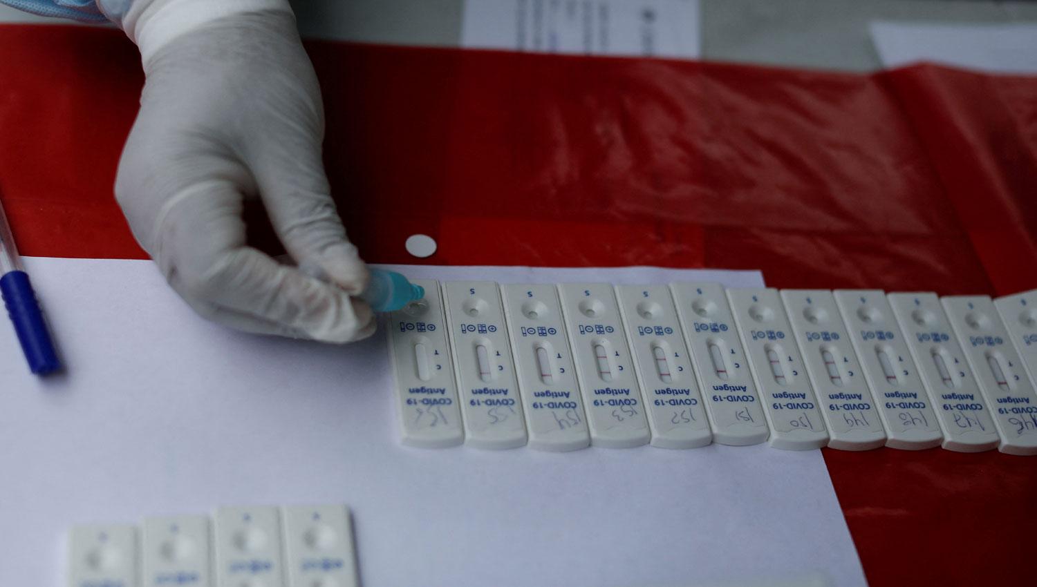 LIMA. Cientos de tests se procesan en Perú, ante el alza de contagios. 