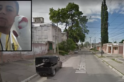 Un cadete fue a entregar un sandwich y lo atacaron con un machete: perdió tres dedos