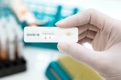 El 30% de los autotest de covid-19 vendidos en farmacias dieron positivo, según cifras oficiales