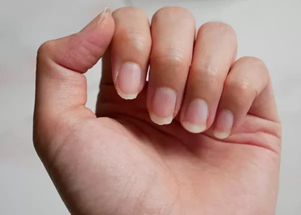 Qué hacer para evitar las uñas quebradizas