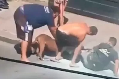 Video: un pitbull atacó a un albañil que caminaba por la vereda: debieron hacerle 27 puntos