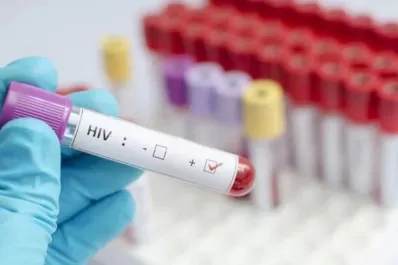 Detectan una nueva variante del VIH: científicos advierten que es más contagiosa y agresiva