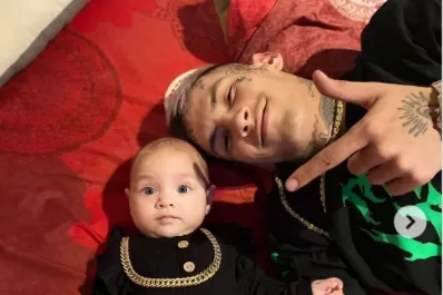 El cantante L-Gante sufrió un accidente y fue enyesado en el brazo derecho