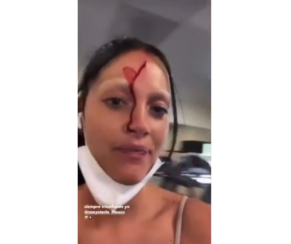 Oriana Sabatini quedó con el rostro ensangrentado tras sufrir un accidente en el gimnasio