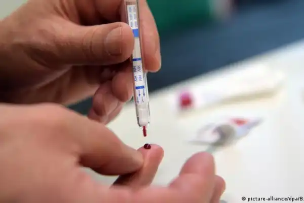Estados Unidos anunció la cura de una mujer con VIH