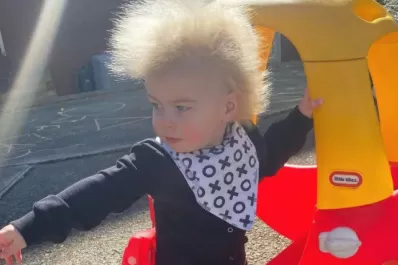 Tiene 16 meses y padece el síndrome del cabello impeinable
