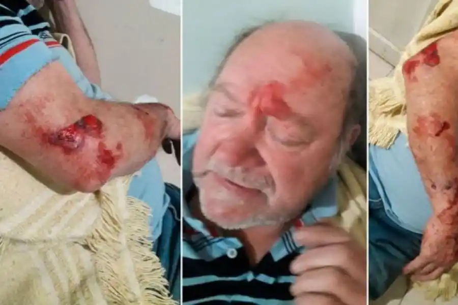 Jorge Ríos fue golpeado salvajemente antes de asesinar al ladrón