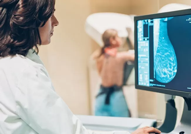 CUIDARSE. La mamografía sigue siendo el estudio médico no invasivo más eficiente para detectar cáncer. 