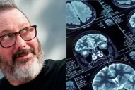 La muerte de Rozín y los tumores cerebrales: ¿hay forma de prevenir uno de los cánceres más letales? 