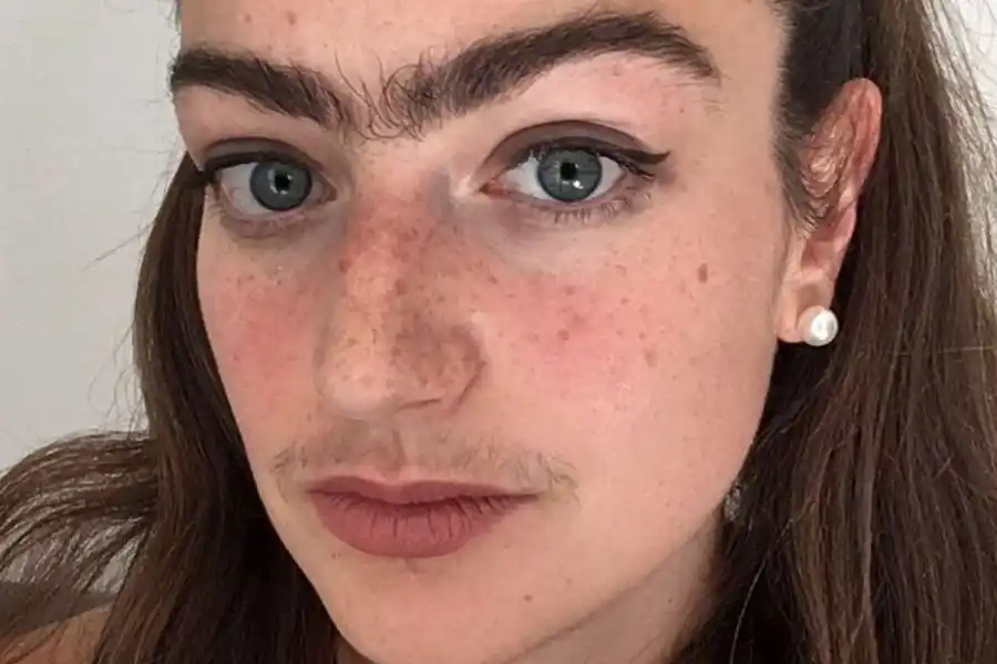 UN AÑO DESPUÉS. Así fue cambiando su rostro.