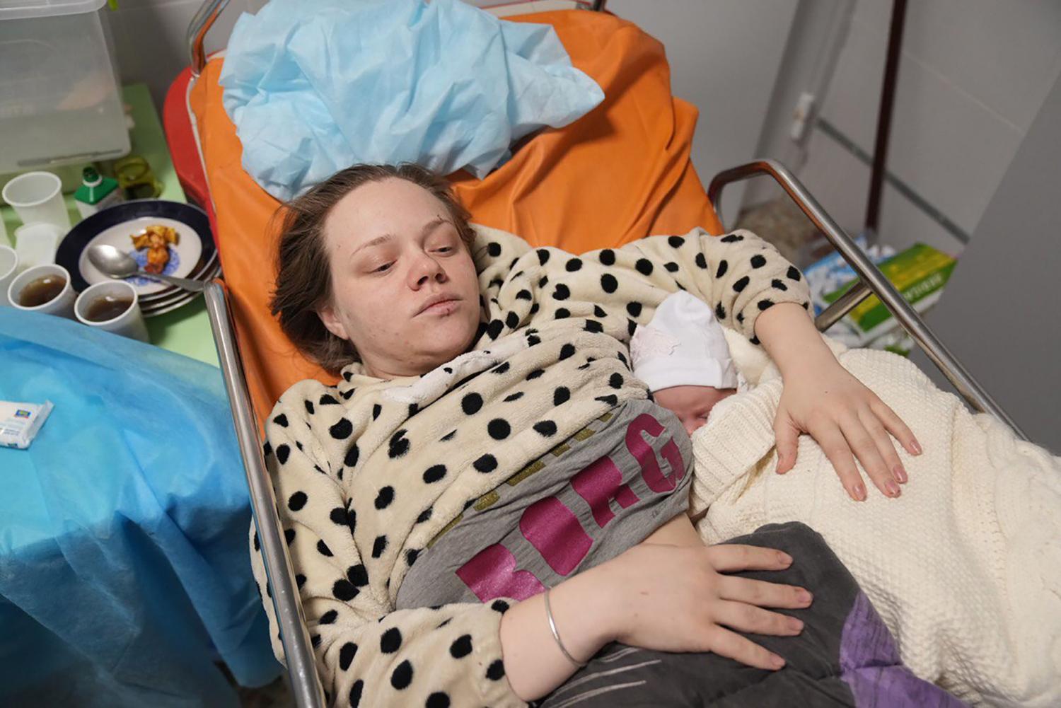 OTRA EMBARAZADA, QUE LOGRO SOBREVIVIR. Mariana Vishegirskaya, tras dar a luz el pasado 11 de marzo en otro hospital de Mariupol. AP