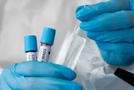 Tener covid y gripe en simultáneo duplica el riesgo de muerte, según un nuevo estudio