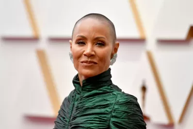 Cuál es la diferencia entre la alopecia y la calvicie