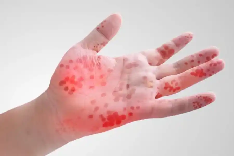 Foto tomada de TodoJujuy.com.ar