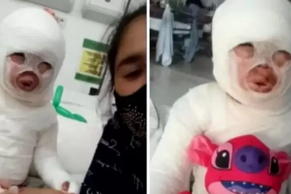 Quemaron con aceite hirviendo a una nena de tres años en un restaurante