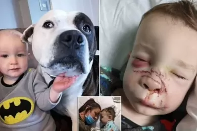 Un bebé fue atacado en la cara por su perro Bull Terrier