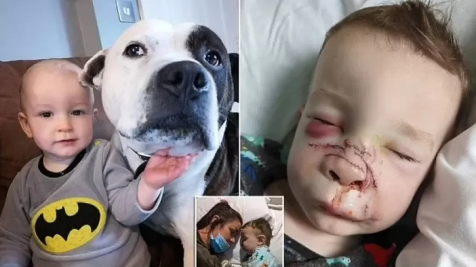 A la izquierda, Romy en una foto junto a su perro antes del ataque. A la derecha, una de las primeras imágenes luego de la cirugía.