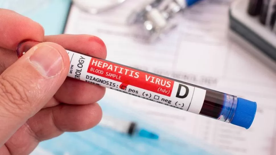 169 CASOS. Son los estimados para esta nueva hepatitis detectada por la OMS.