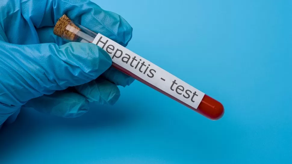 HEPATITIS AGUDA INFANTIL. Se detectó un caso sospechoso en San Juan.