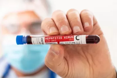 La revista The Lancet publicó un estudio que vincula la hepatitis aguda en niños con el coronavirus