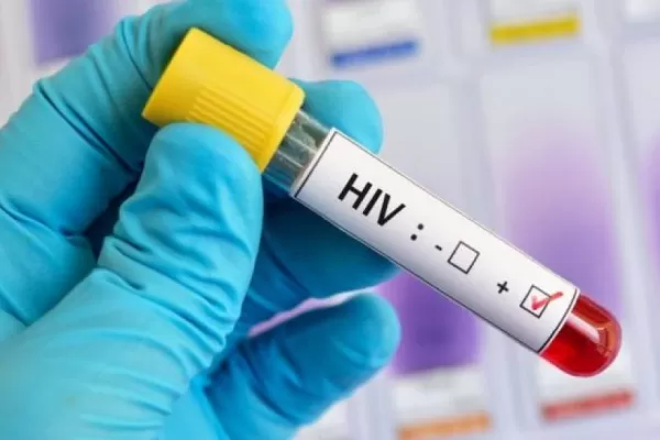 El Gobierno reglamentó la ley de respuesta integral para personas con VIH y hepatitis virales