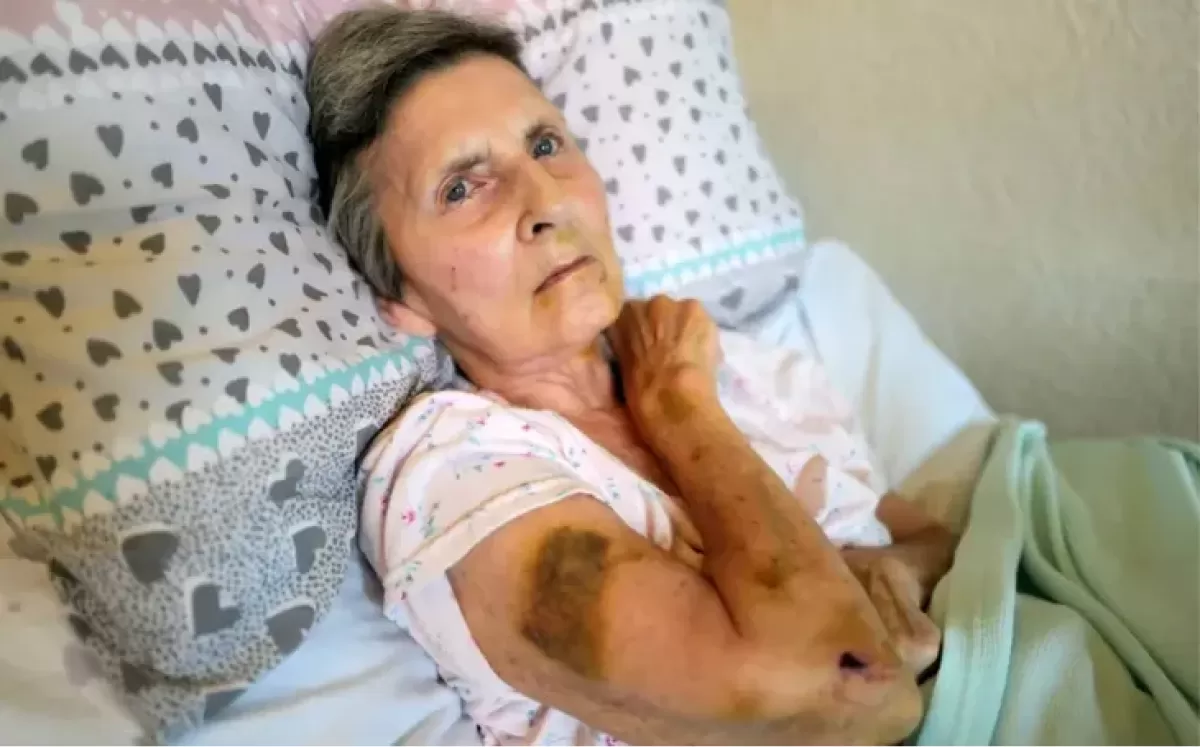 Diana Kirk fue atacada por una rata gigante de 22 centimetros.