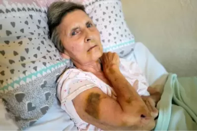 Una mujer fue atacada por una rata gigante y la salvó un vecino