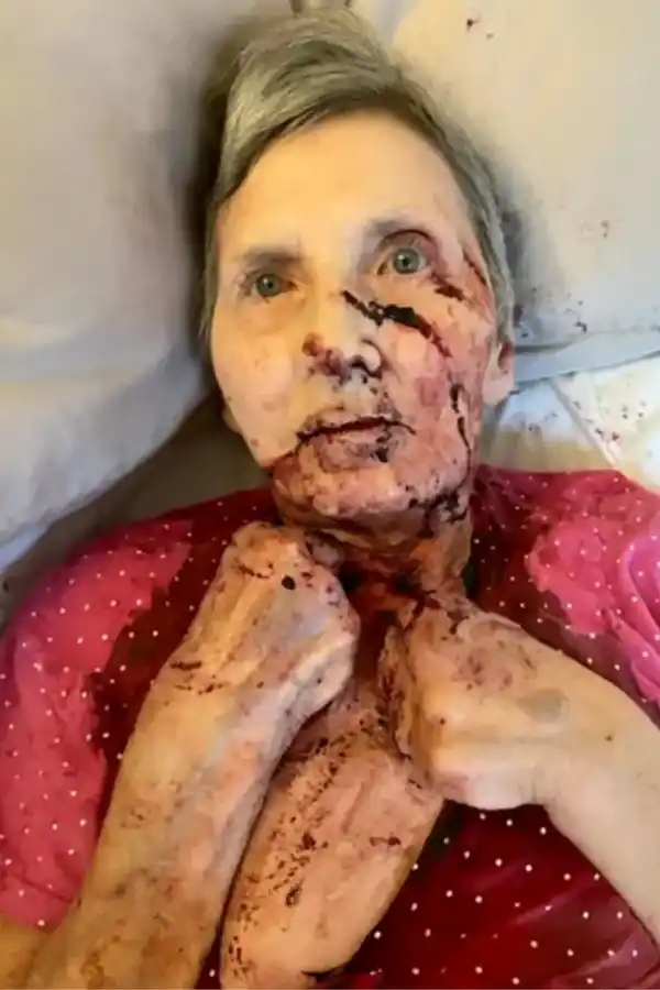 Una mujer fue atacada por una rata gigante y la salvó un vecino