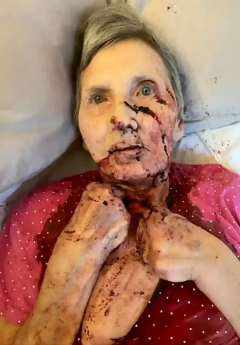 Una mujer fue atacada por una rata gigante y la salvó un vecino