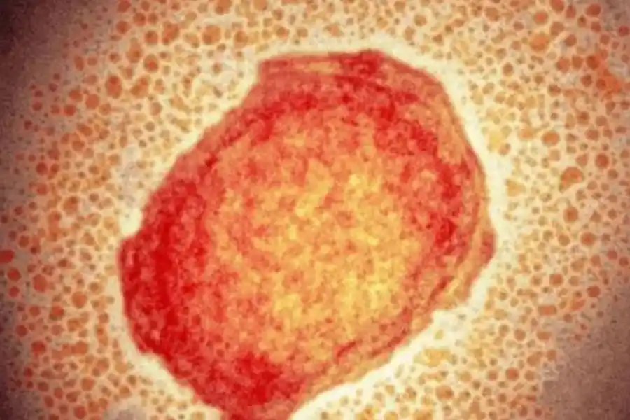 Una pequeña particula del virus de la viruela del mono.