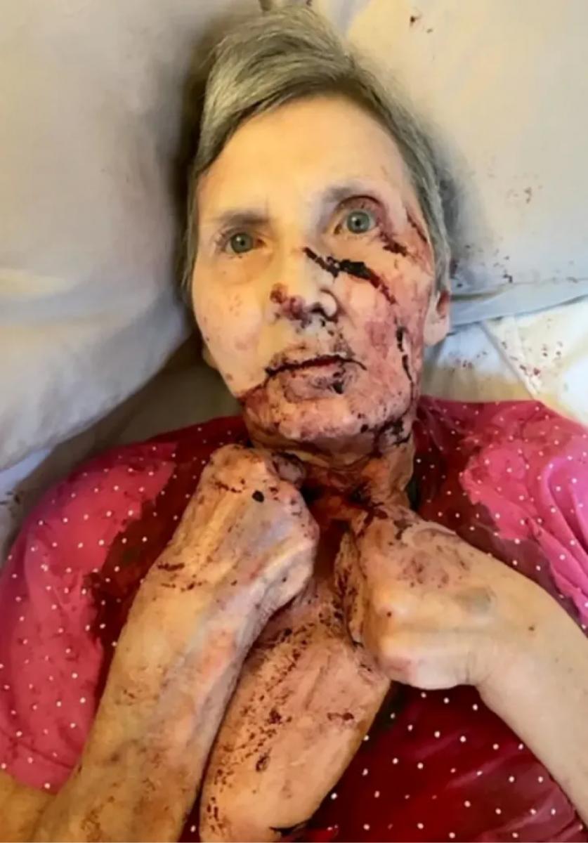 Una mujer fue atacada por una rata gigante y la salvó un vecino