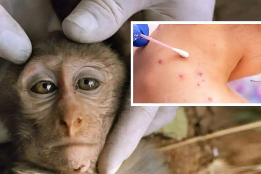 RARA INFECCIÓN. Los servicios sanitarios europeos están en alerta. 