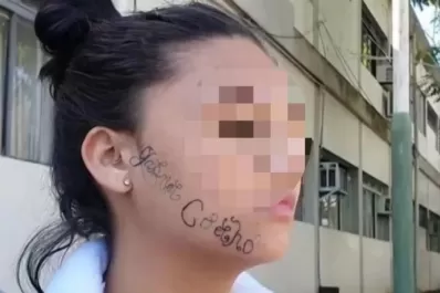 La secuestró su ex novio y le tatuó su nombre en la cara para que fuera de su “propiedad”