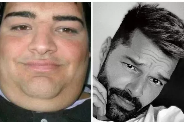 Participó en Cuestión de peso, y se hizo más de 30 cirugías para parecerse a Ricky Martin