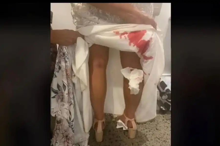 El vestido lleno de sangre.